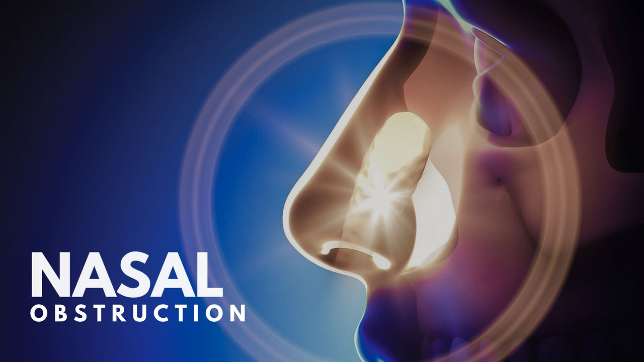 Nasal Obstruction & Sleep Apnea